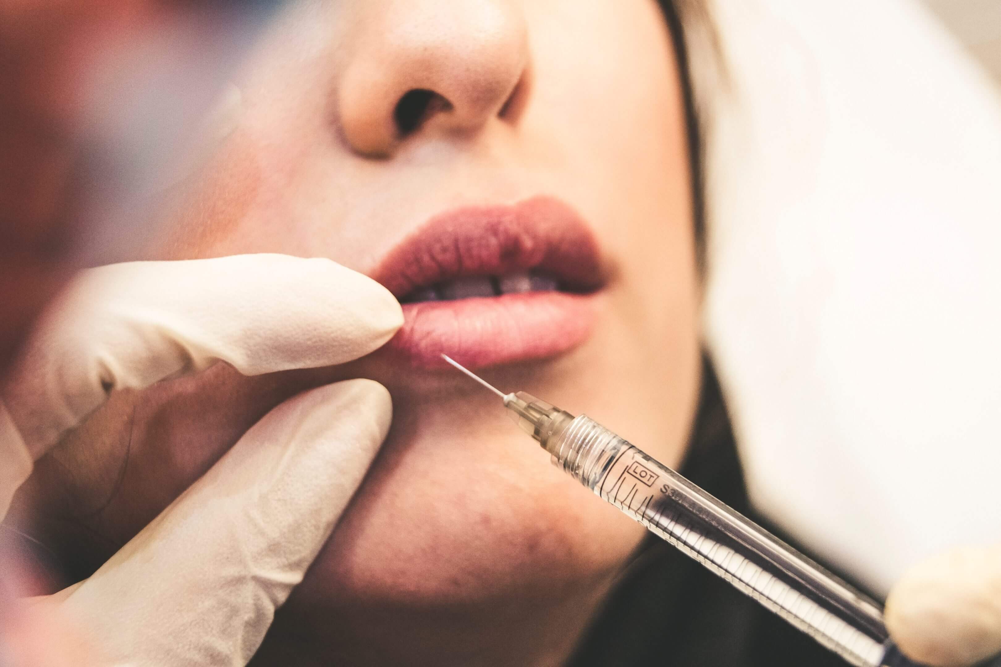 Lip-Injection-1-scaled (1) Lip-Injection-1-scaled (1)