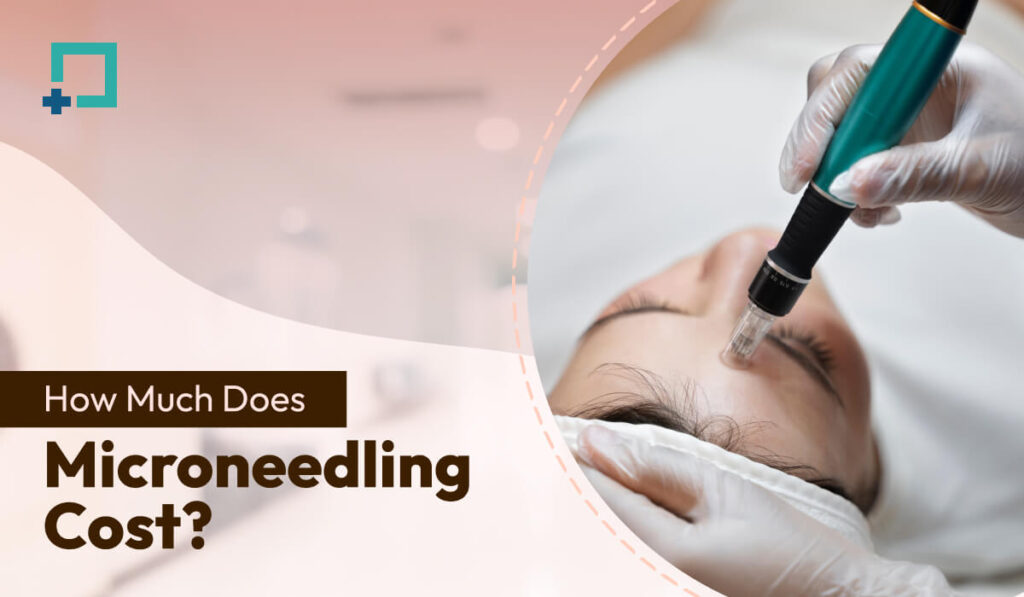 How Much Does Microneedling Cost?