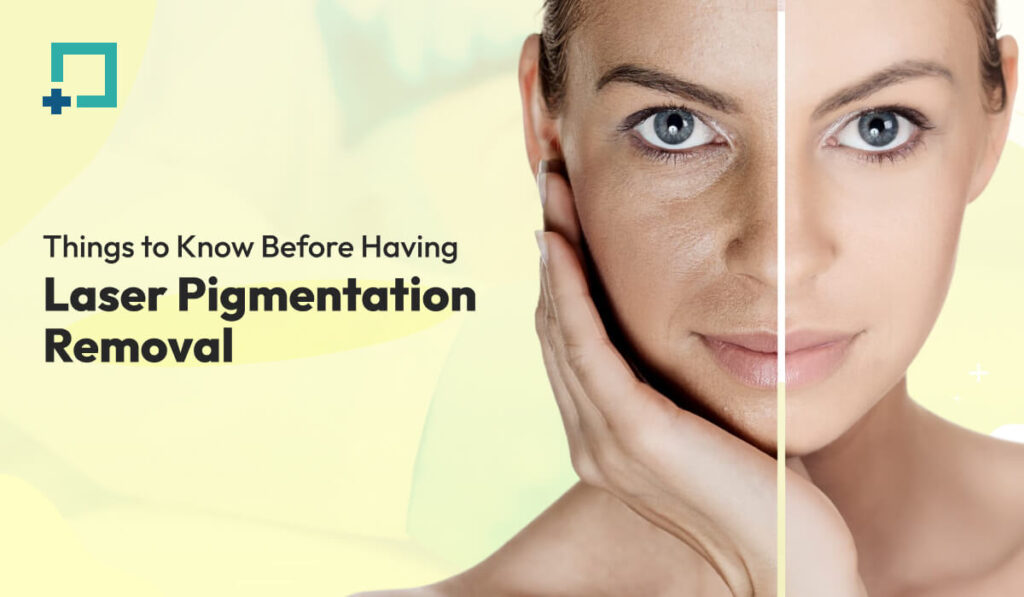 Things to Know Before Having Laser Pigmentation Removal
